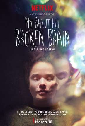 My Beautiful Broken Brain Imagem